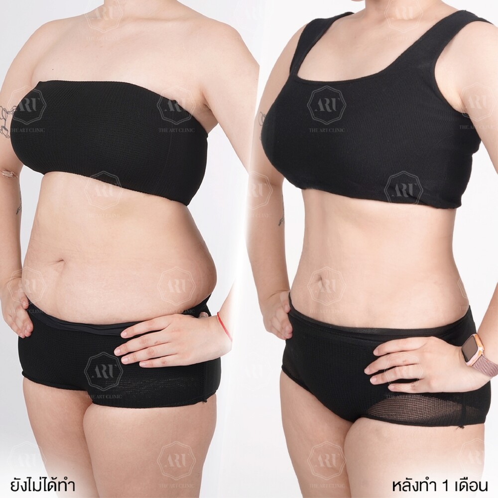 Clinic Results Gallery